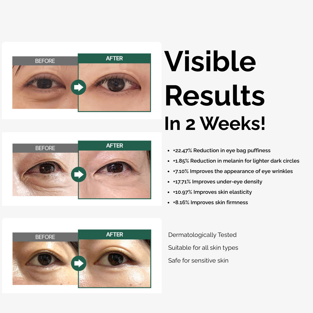 Someblossom Spicular Eyebag Removal Cream 10ml